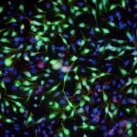GenePORTER 3000 Transfection Reagent