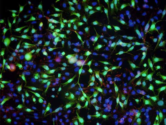GenePORTER 3000 Transfection Reagent