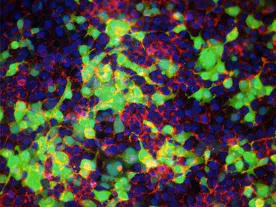 GenePORTER Gold Transfection Reagent