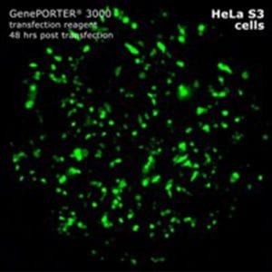 Geneporter image 7