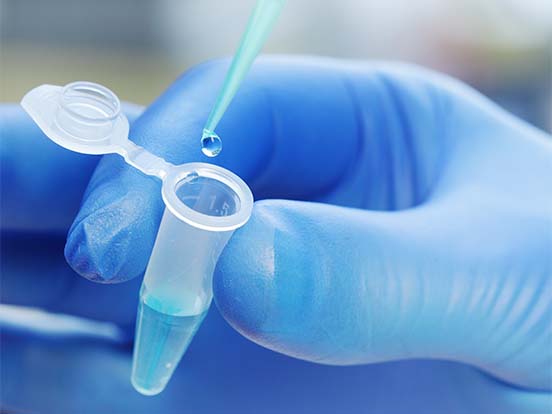 HeavyLabeled FullLength Proteins as MS Standards
