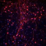 NeuroPure Rat Neuronal Cells