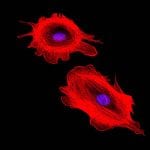 Oris Cell Migration Assays