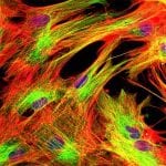 Oris Pro Cell Migration Assays