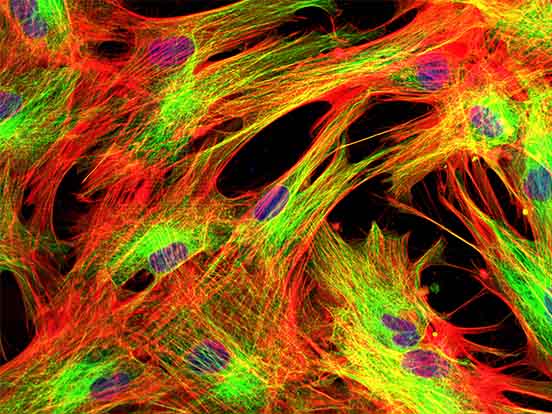 Oris Pro Cell Migration Assays