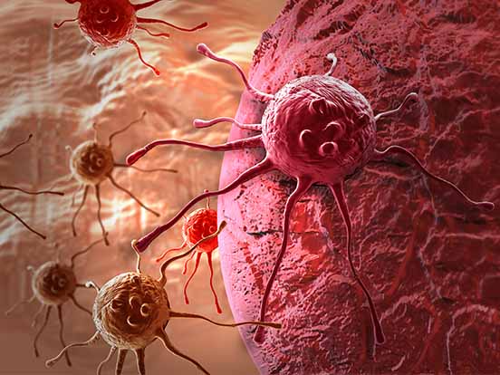 Cancer Research