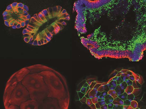 Organoid Cell Culture 038 Cryopreservation