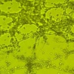 In Vitro Angiogenesis Assays