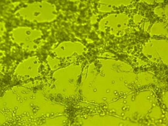 Maptrix hygel extracellular