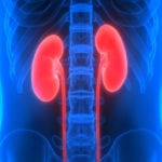 KIM1 Tests for Kidney Damage Detection