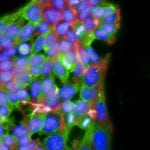 Heparan Sulfate Antibodies