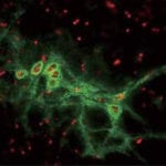 Chondroitinase ABC