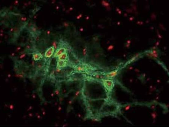 Chondroitinase ABC