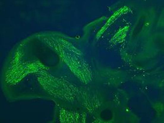 Green Fluorescent Protein GFP Polyclonal Antibody