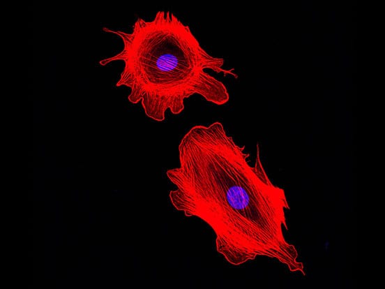 Human Primary Cancer Cells