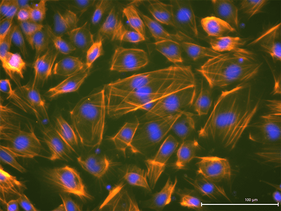 StemFit Purotein Recombinant Proteins