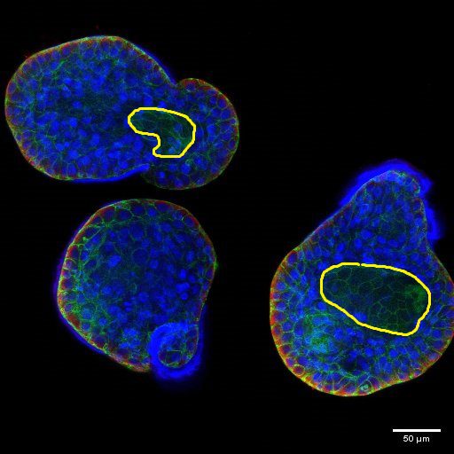 Cryopreservation of Organoids