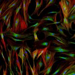 Human Normal Primary Cells