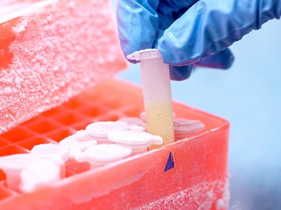 CELLBANKER Cell Freezing Media