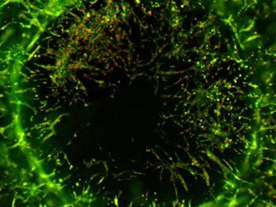 Oris Cell Invasion Assays