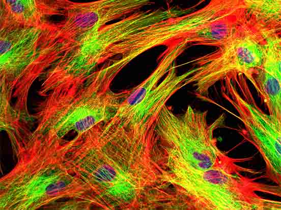 BioPORTER Protein Delivery Reagent