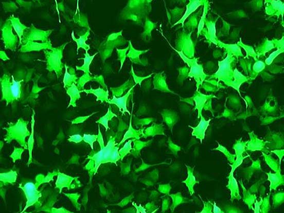 GenePORTER 2 Transfection Reagent