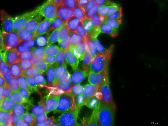 Heparan Sulfate Antibodies