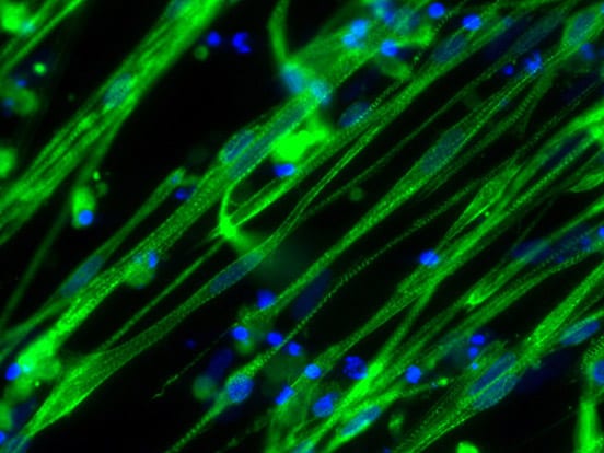 Skeletal Muscle Differentiation Kit