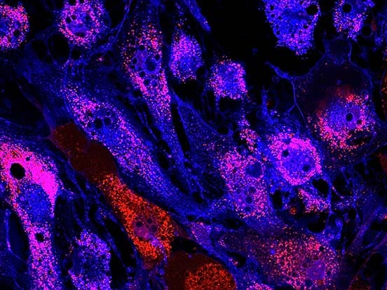 StemFit For Mesenchymal Stem Cells