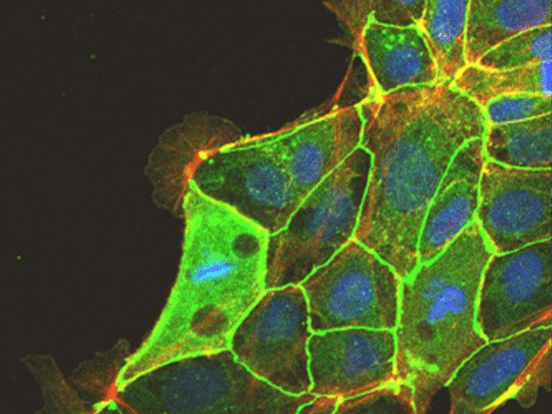 iMatrix511 Recombinant Laminin E8 Fragments