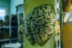 Brain-in-a-jar-scaled-300x200